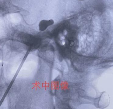 Ժ20حʹ漡ε­񾭼(ͼ2)